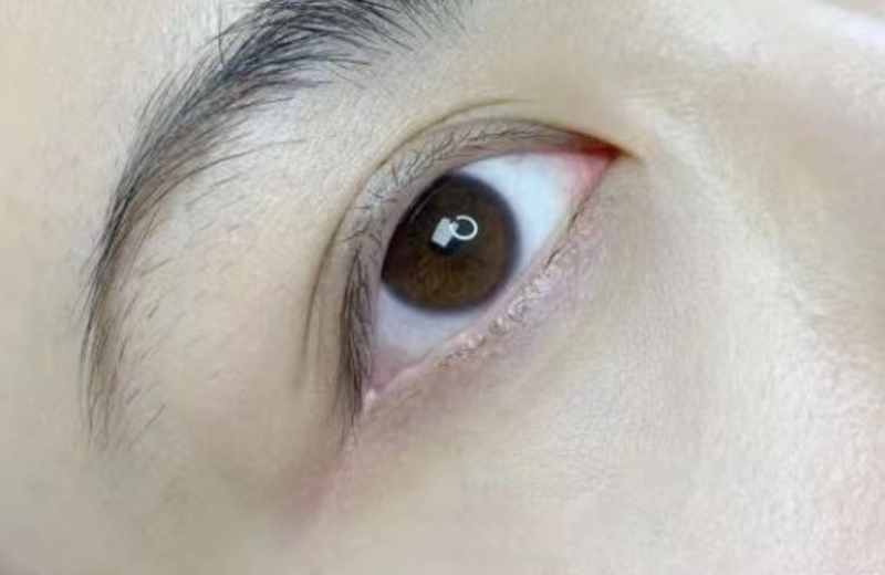 美瞳线